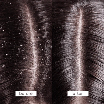 PUMP - Scalp Therapy Conditioner