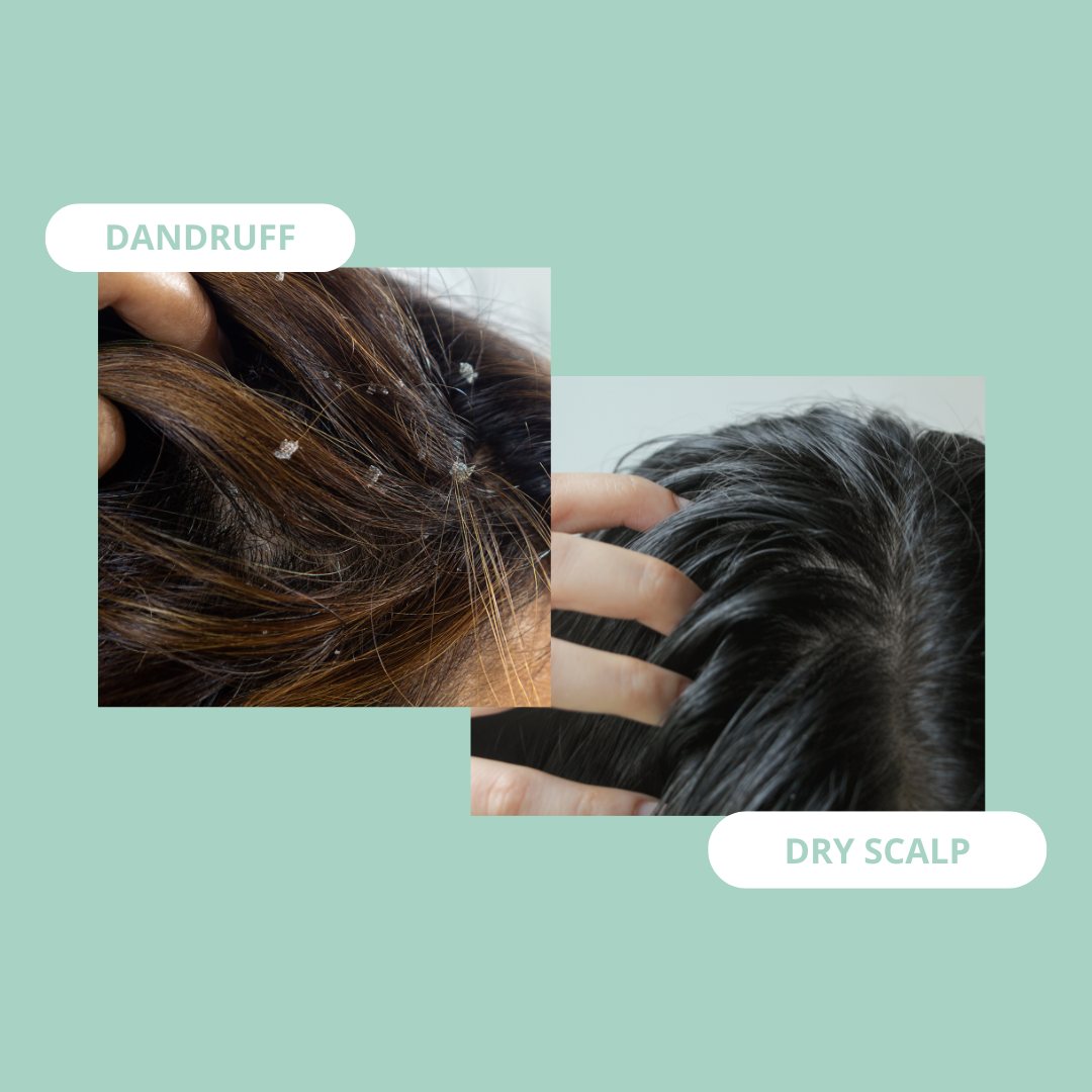 Pump Scalp Tonic Trio